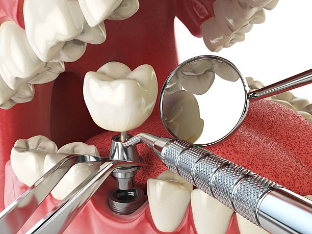 Best Emergency Dental Surgery in Gramercy, LA