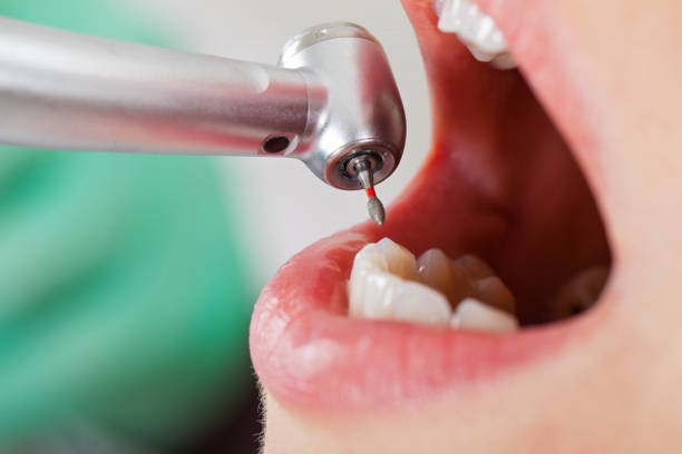 Best Emergency Broken Tooth Repair in Gramercy, LA